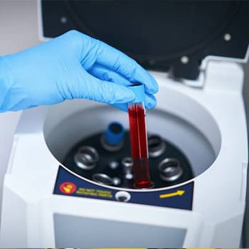 SLES  vortex mixer stirrer